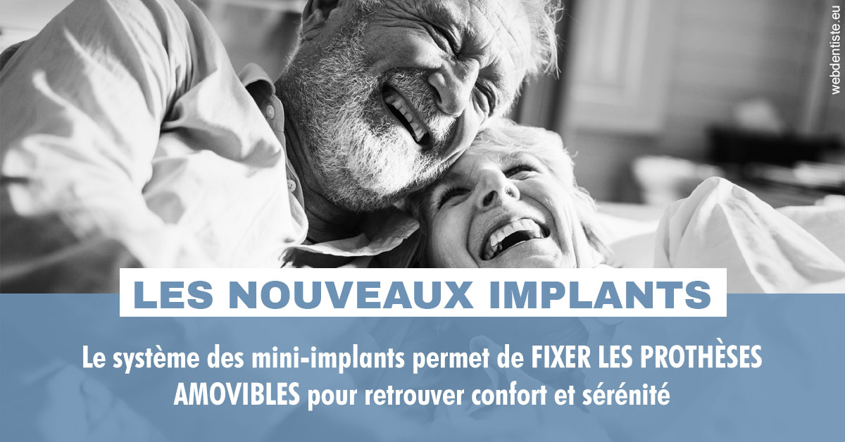 https://www.centredentairedeclamart.fr/Les nouveaux implants 2