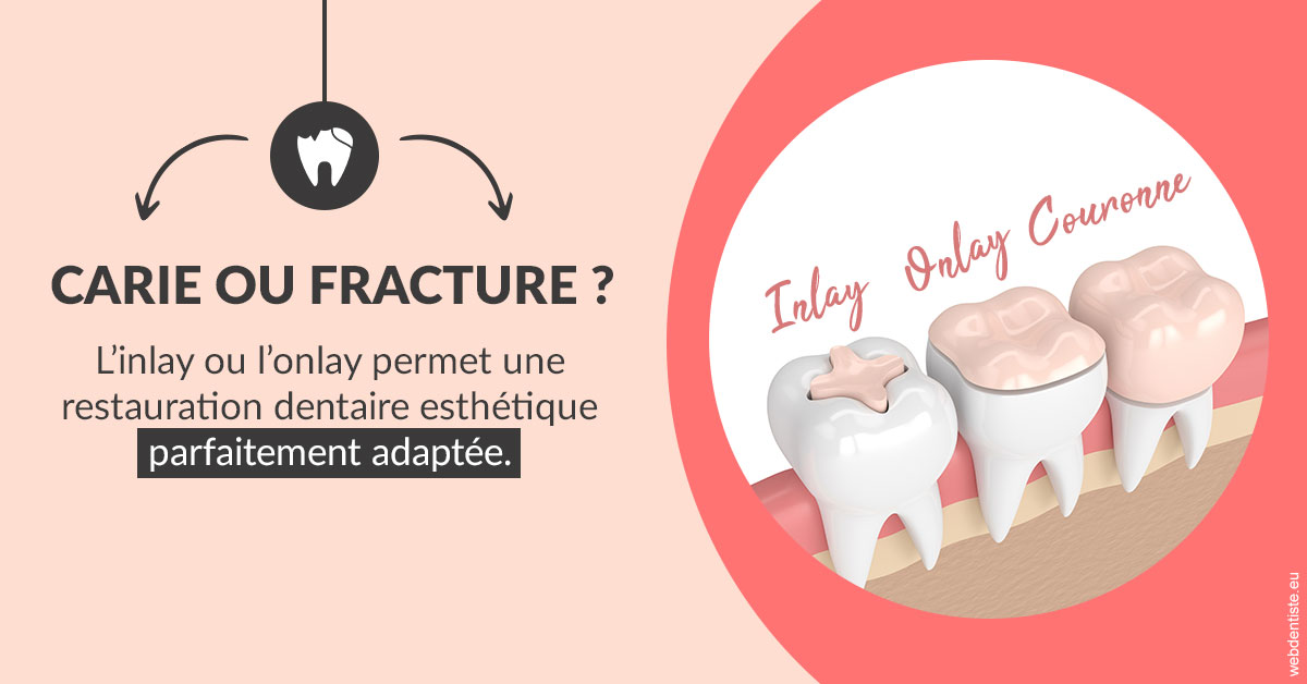 https://www.centredentairedeclamart.fr/T2 2023 - Carie ou fracture 2