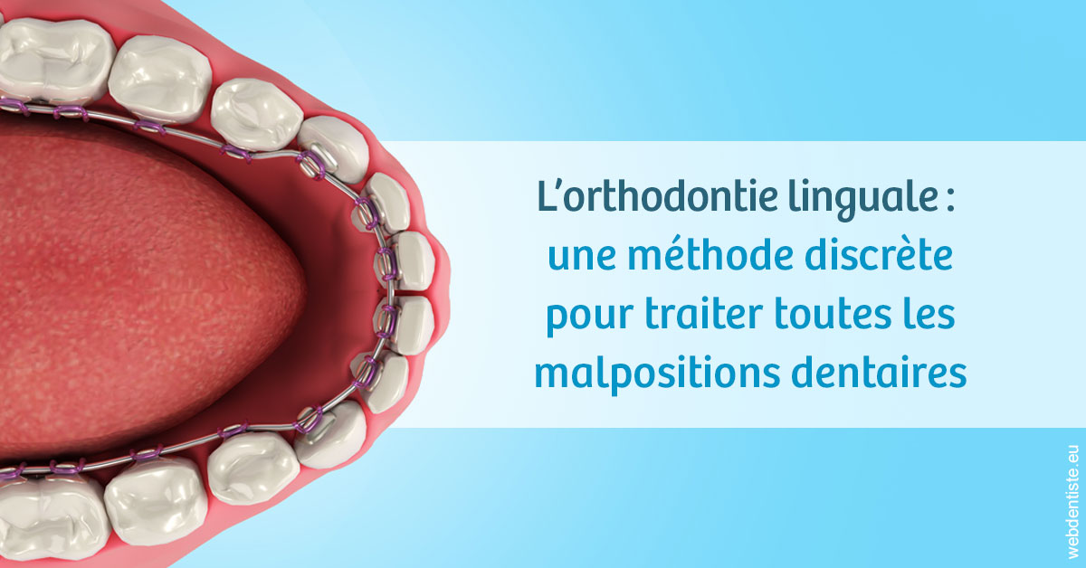 https://www.centredentairedeclamart.fr/L'orthodontie linguale 1