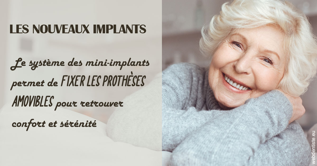 https://www.centredentairedeclamart.fr/Les nouveaux implants 1