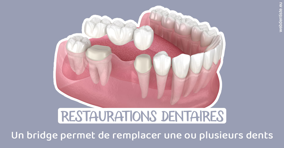 https://www.centredentairedeclamart.fr/Bridge remplacer dents 1