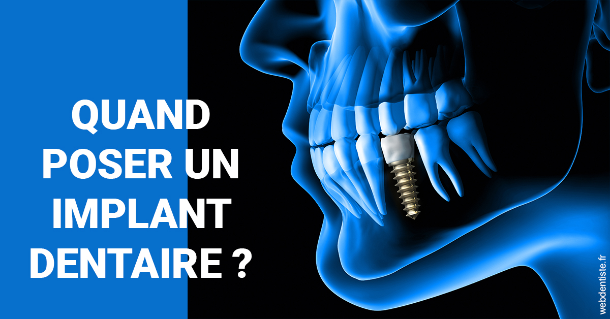 https://www.centredentairedeclamart.fr/Les implants 1