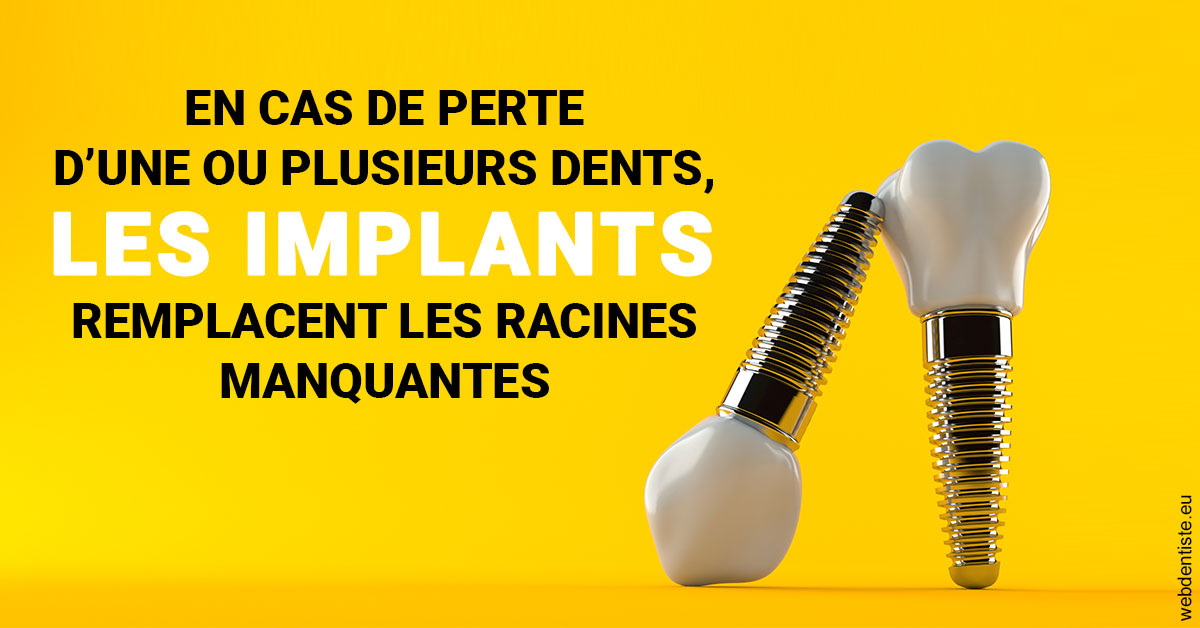 https://www.centredentairedeclamart.fr/Les implants 2