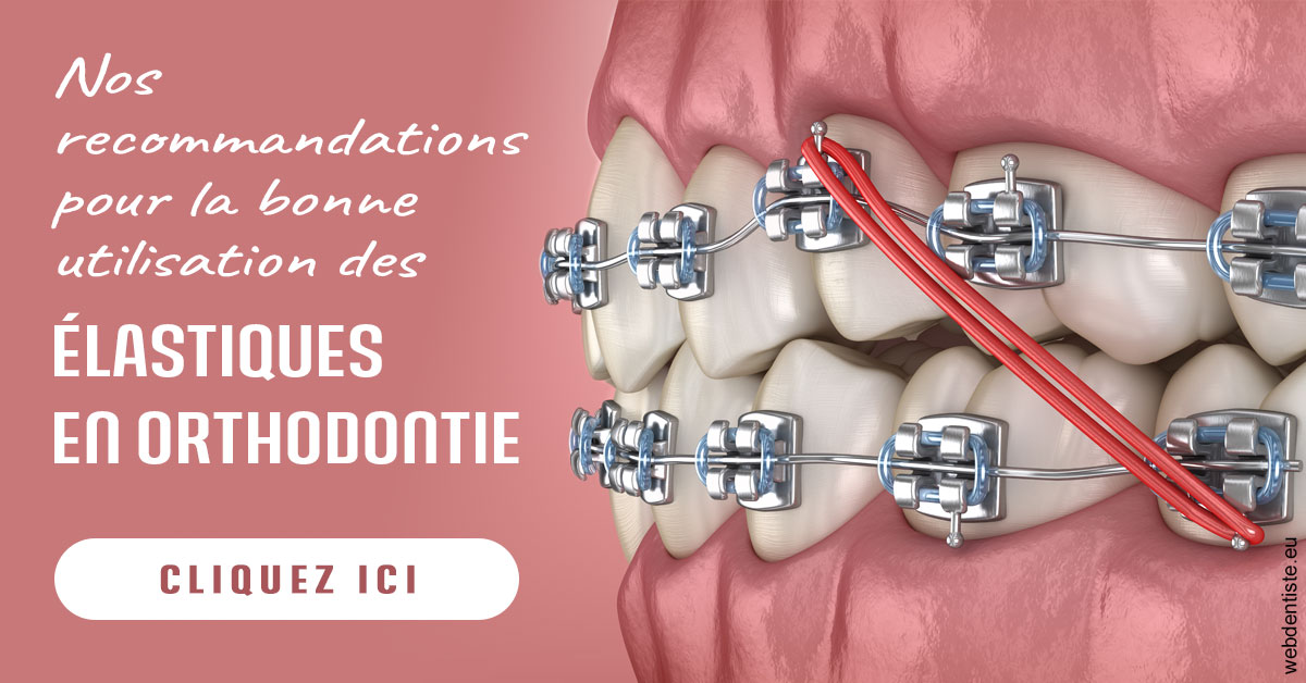 https://www.centredentairedeclamart.fr/Elastiques orthodontie 2